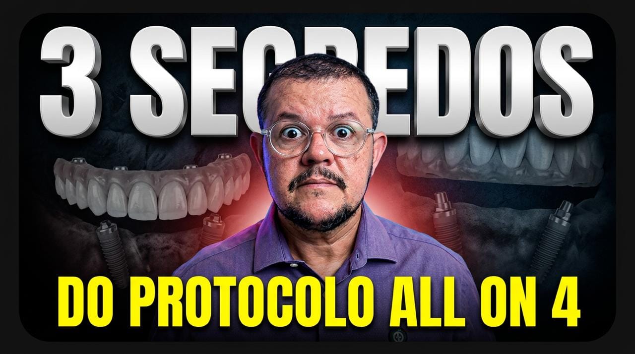 Dentista explicando 3 segredos do protocolo All-on-4 para quem busca dentes fixos em Campinas.