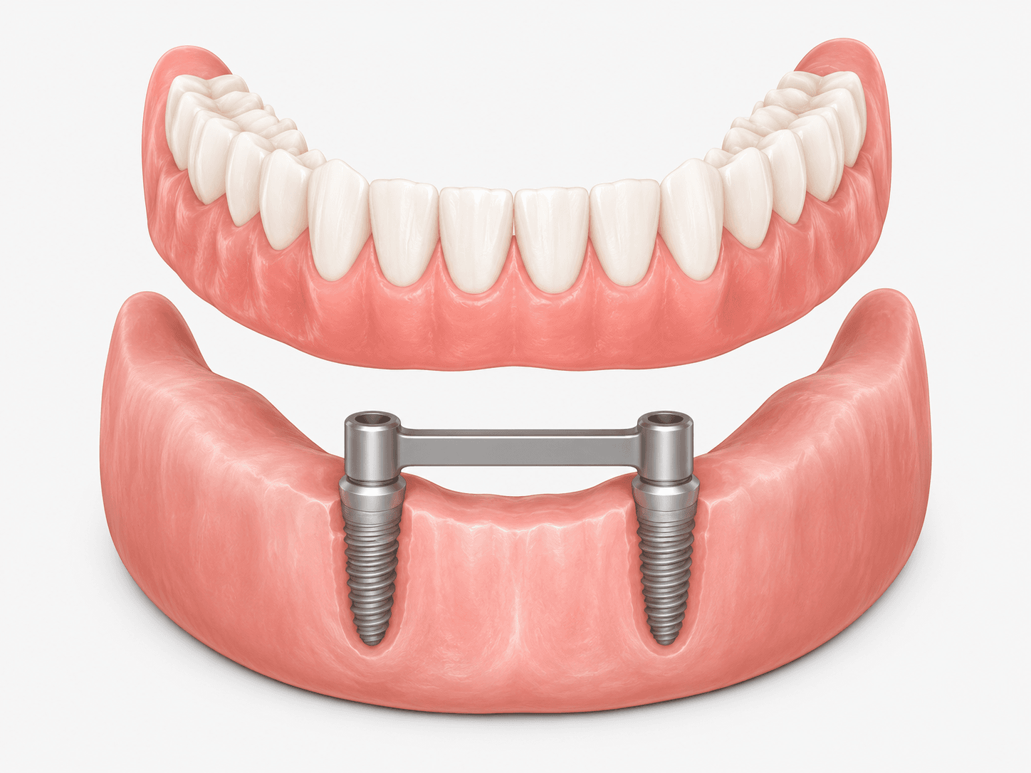 Dentista explicando a diferença entre prótese protocolo e overdenture na Freitas Odontologia em Campinas.